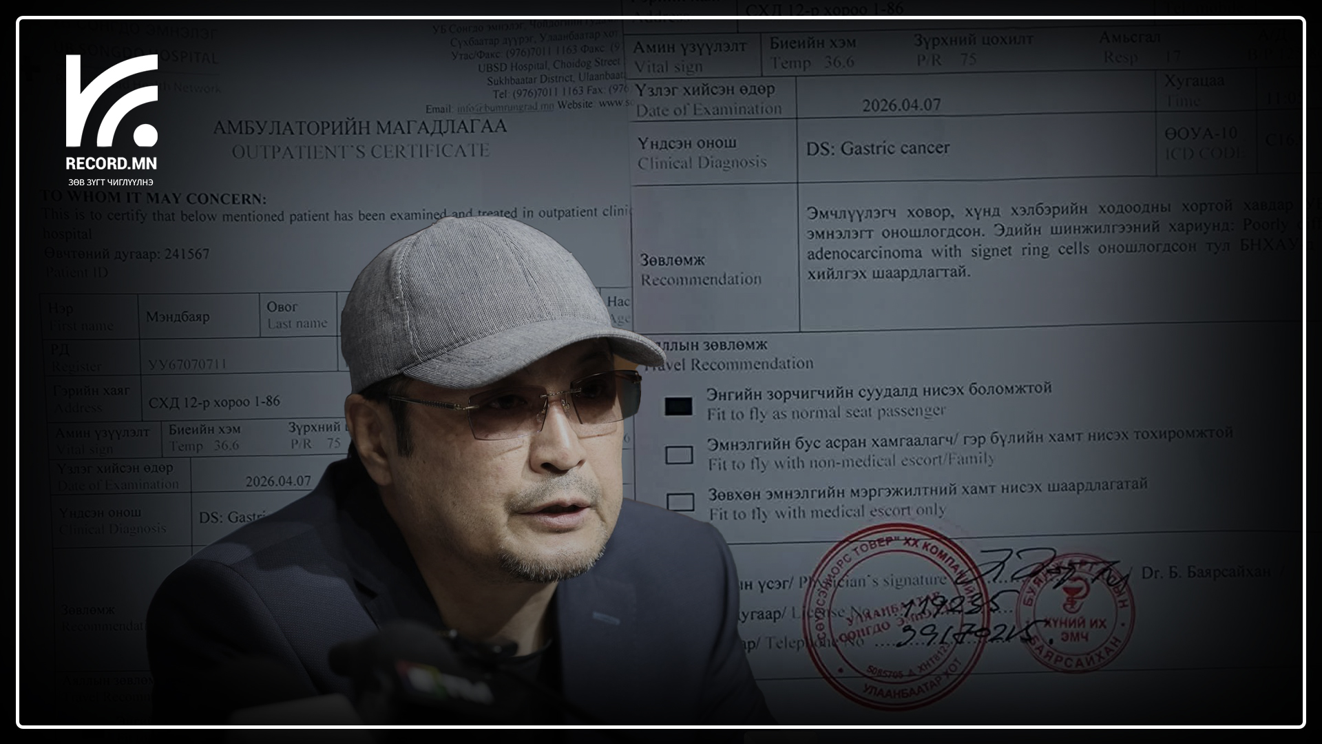 Глобын  Ж.Мэндбаяр хорт хавдраар өвчилжээ