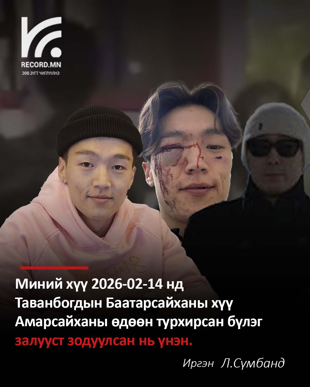 Миний хүү 2026-02-14 нд Таванбогдын Баатарсайханы хүү Амарсайханы өдөөн турхирсан бүлэг залууст зодуулсан нь үнэн